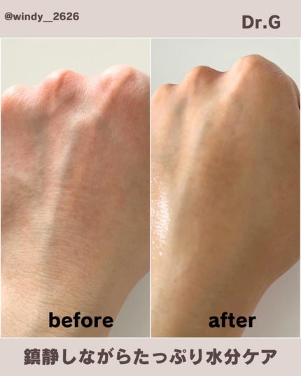 レッドB・Cスムージングクリーム/Dr.G/フェイスクリームを使ったクチコミ(4枚目)