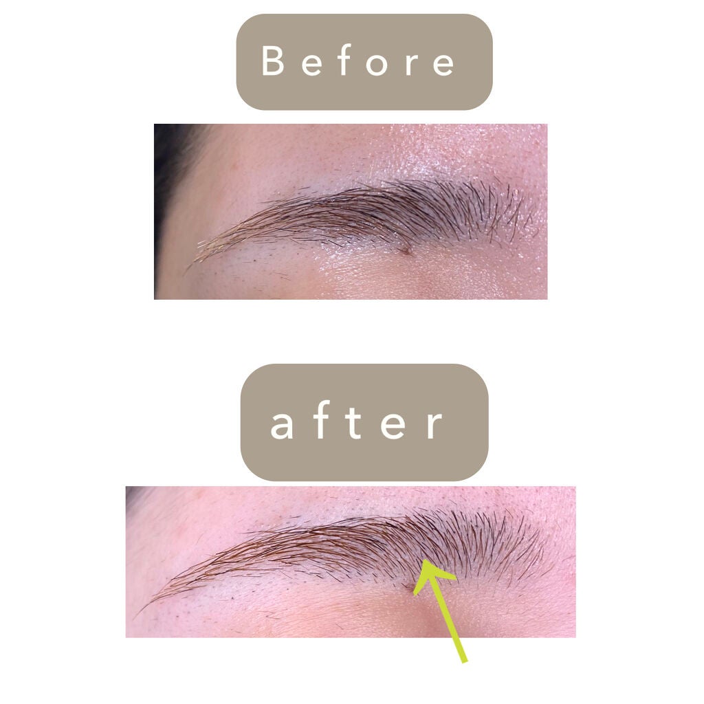 脱色クリーム 敏感肌用/エピラット/ムダ毛ケアを使ったクチコミ(2枚目)