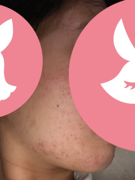 を使ったクチコミ(2枚目)