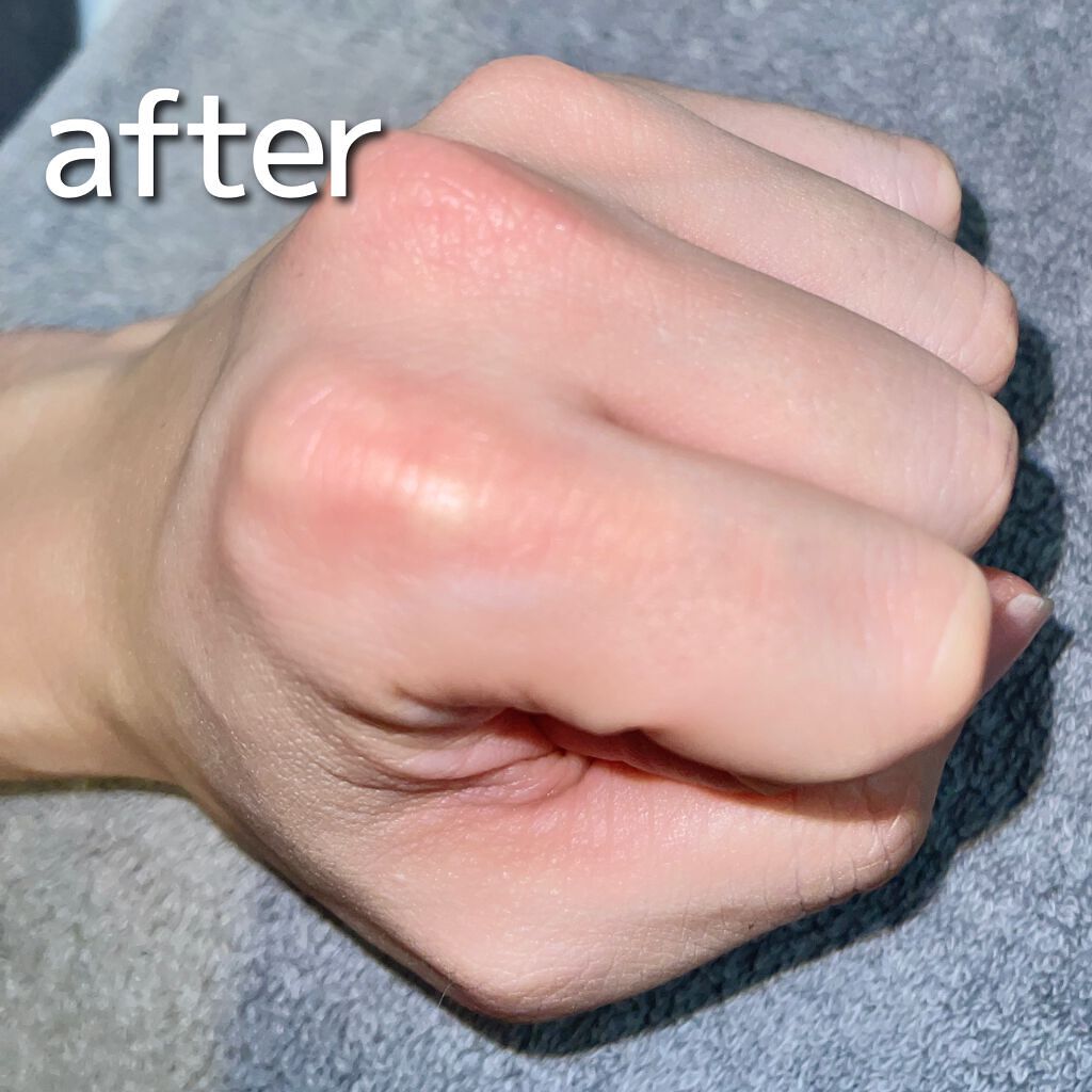 NONON/NONON(ノンノン)/除毛クリームを使ったクチコミ(6枚目)