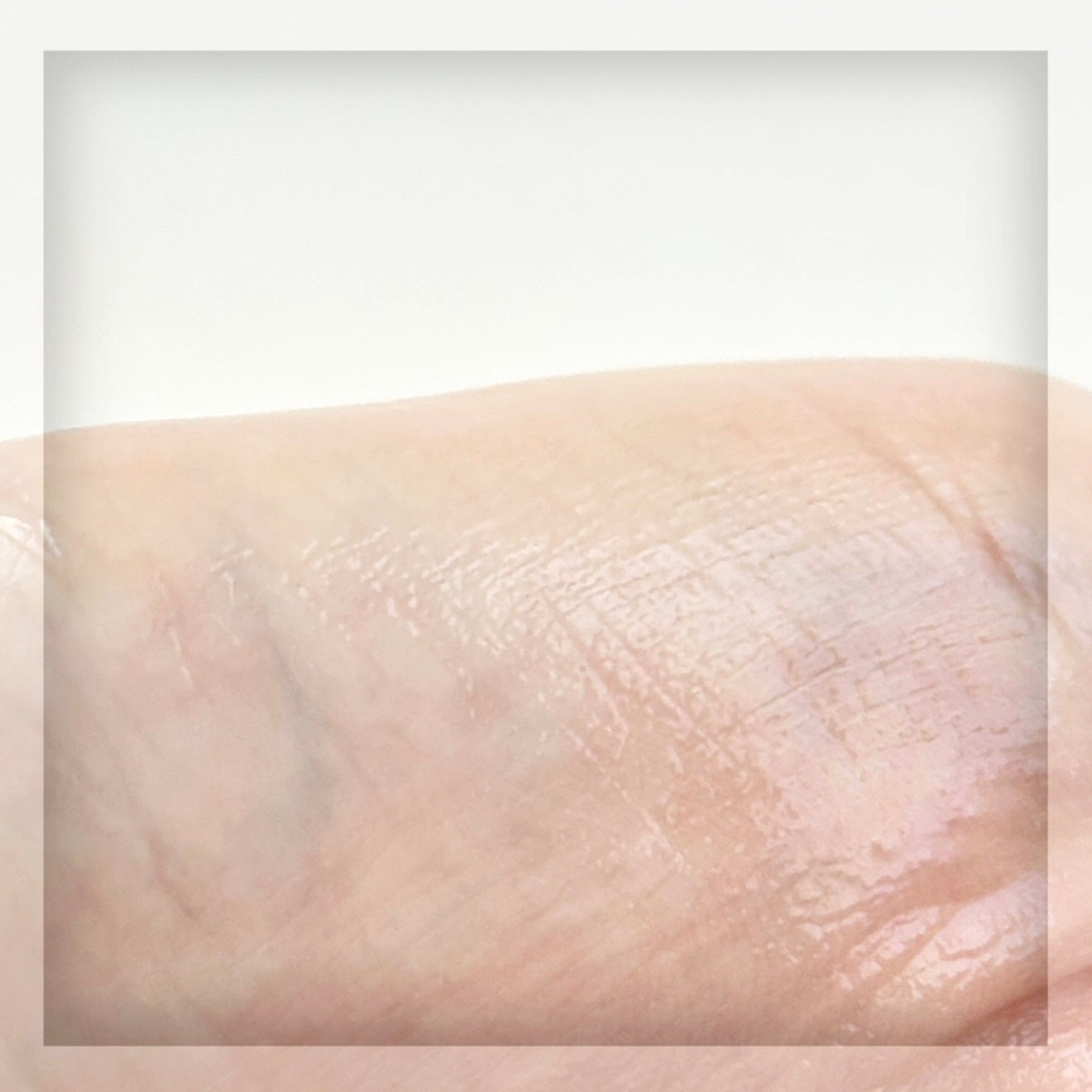 ジンクテカBセラム/BRING GREEN/美容液を使ったクチコミ(5枚目)