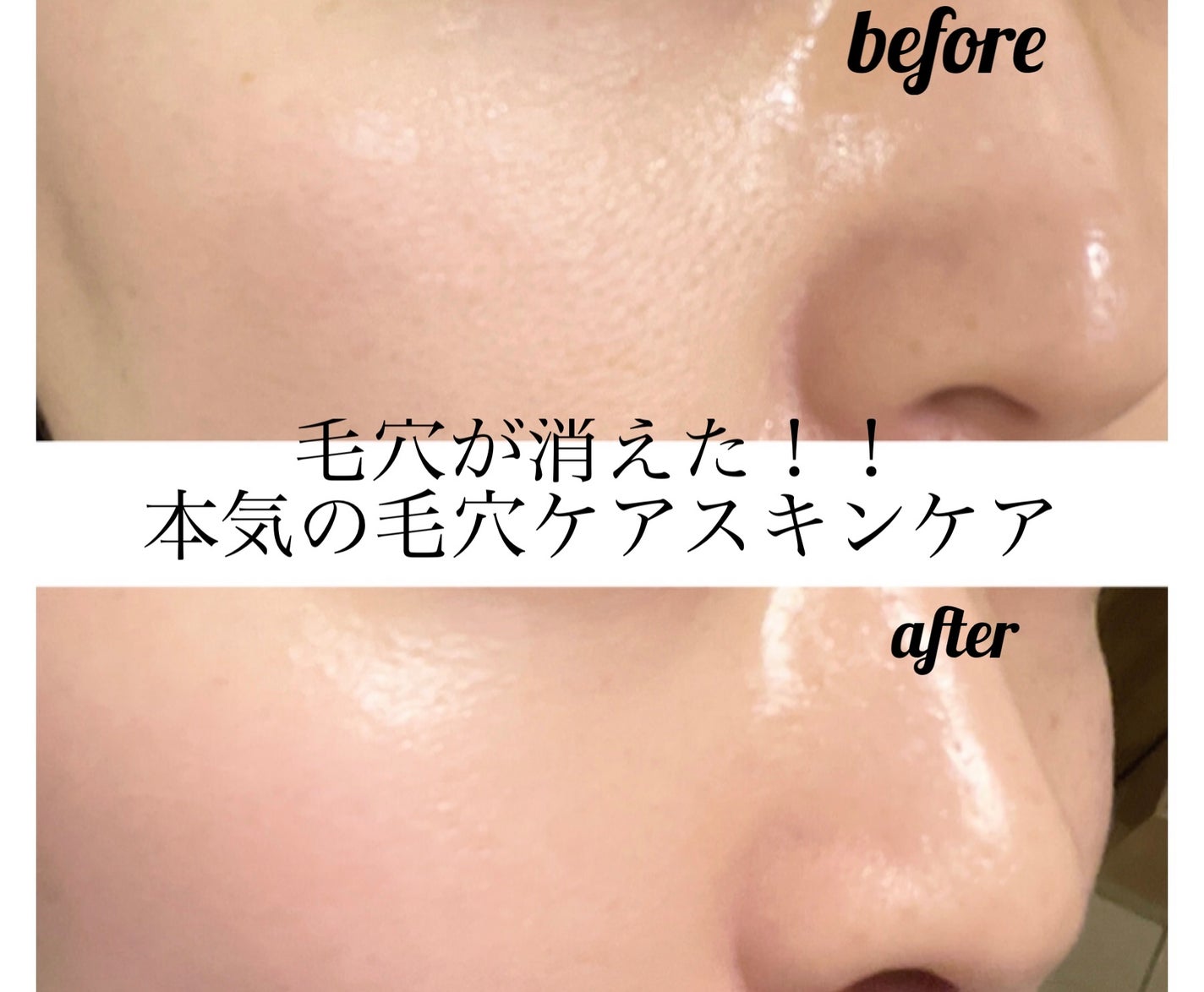 リードルショット300/VT/美容液を使ったクチコミ(1枚目)