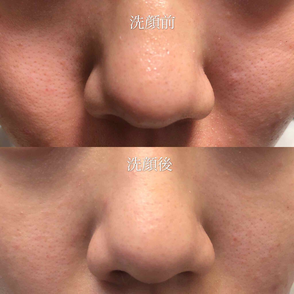 酵素洗顔パウダー/雪肌粋/洗顔パウダーを使ったクチコミ（2枚目）