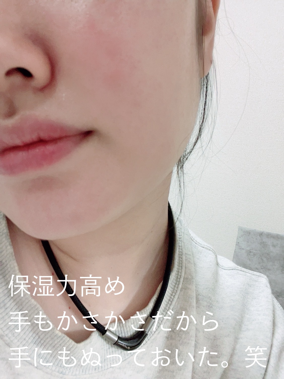 レッドブレミッシュ クリアモイスチャークリーム/Dr.G/フェイスクリームを使ったクチコミ（3枚目）