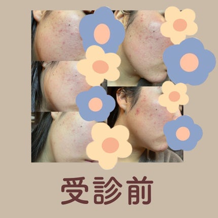 100日後に垢抜けたい女 on LIPS 「【皮膚科やめた話】こんにちは。「100日後に垢抜けたい女」です..」(2枚目)