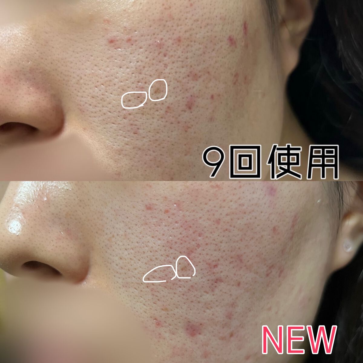 ドクダミ化粧水/ONE THING/化粧水を使ったクチコミ(4枚目)