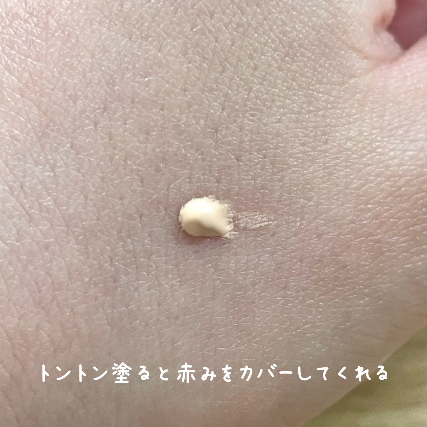 イプノス シーバムクリア リペアクリーム/ACSEINE/フェイスクリームを使ったクチコミ(3枚目)