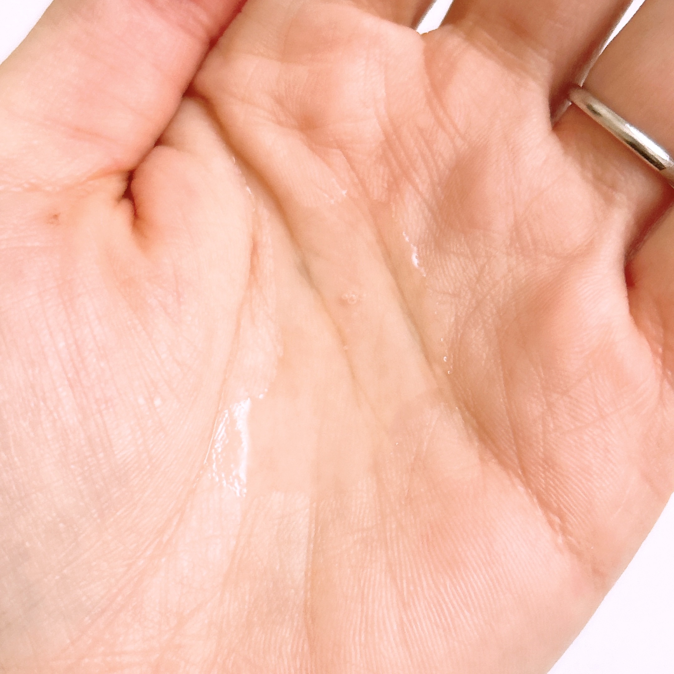 VC100エッセンスローション EX/ドクターシーラボⓇ/化粧水を使ったクチコミ（3枚目）