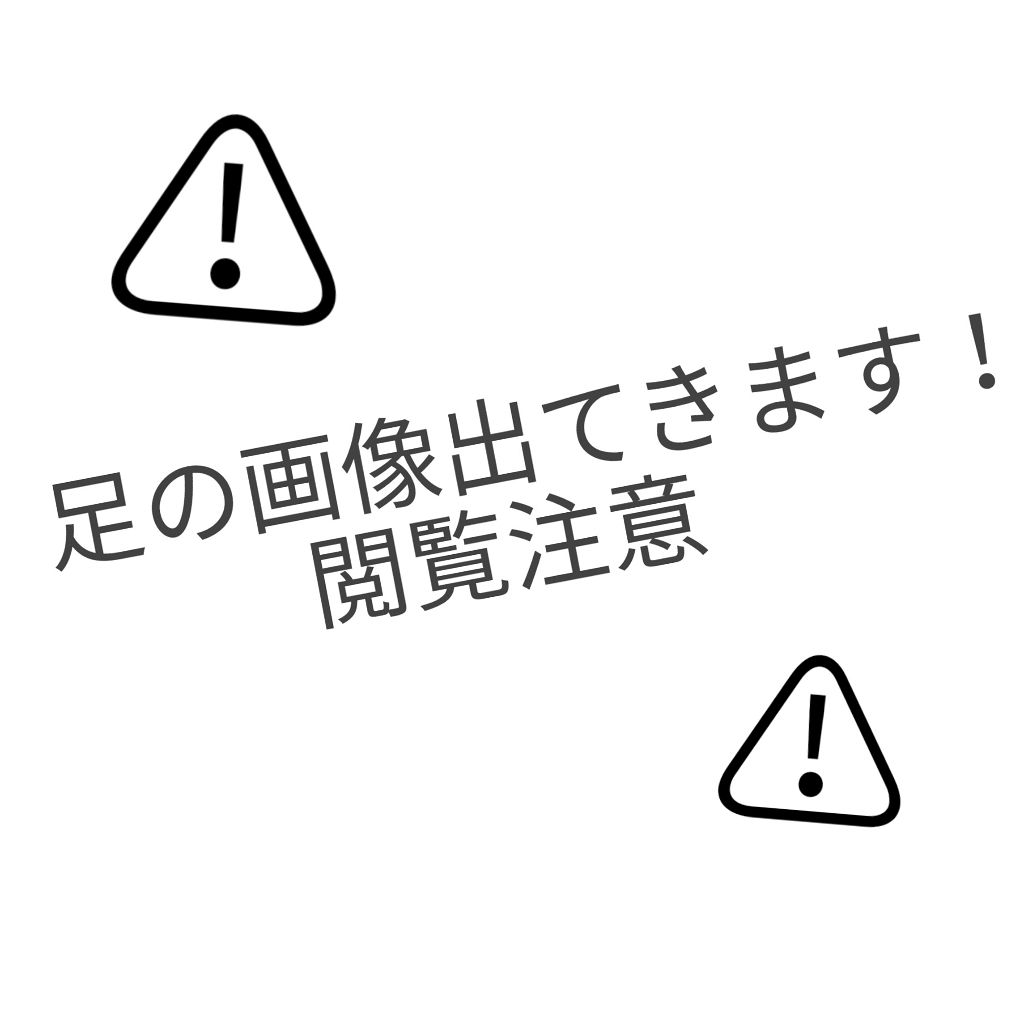 除毛クリームキット敏感肌用/エピラット/除毛クリームを使ったクチコミ（1枚目）