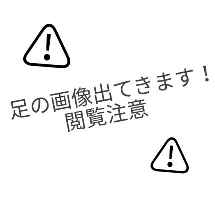 除毛クリームキット敏感肌用/エピラット/除毛クリームを使ったクチコミ(1枚目)