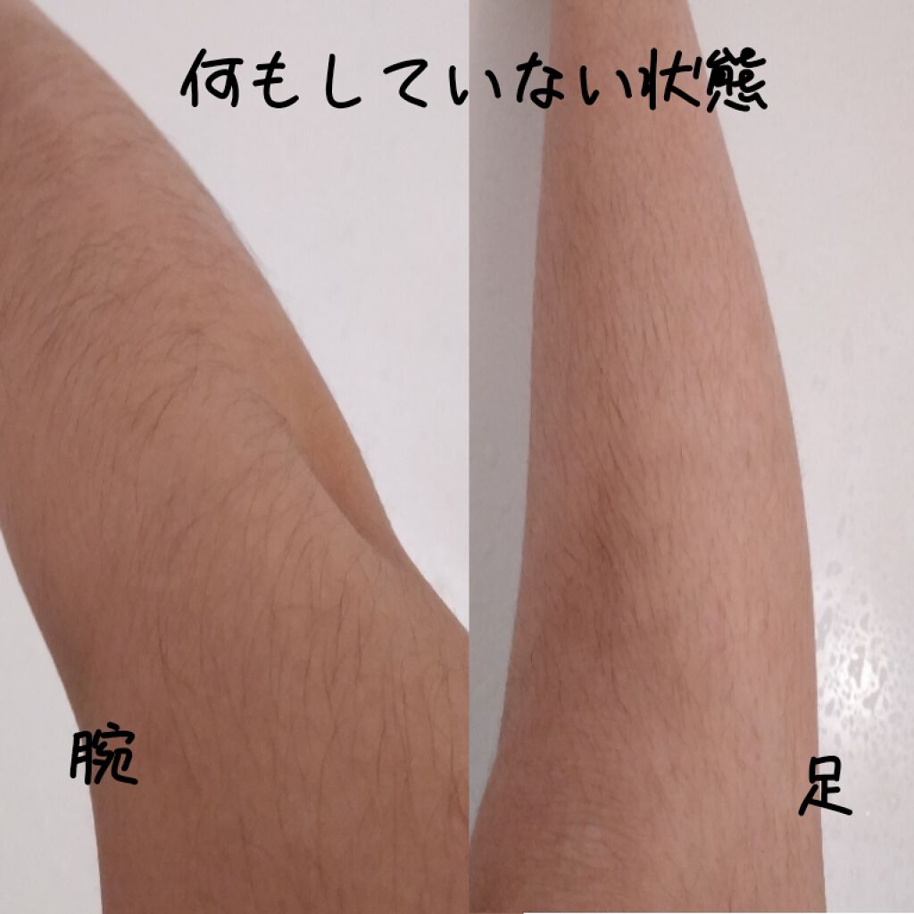 FASIZ607C IPL光脱毛器/FASIZ/家庭用脱毛器を使ったクチコミ（3枚目）