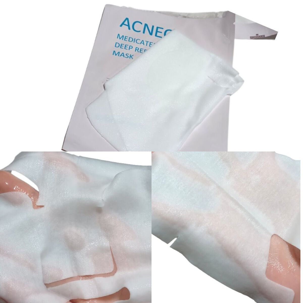 薬用 ディープリペア マスク/アクネオ/シートマスク・パックを使ったクチコミ(3枚目)