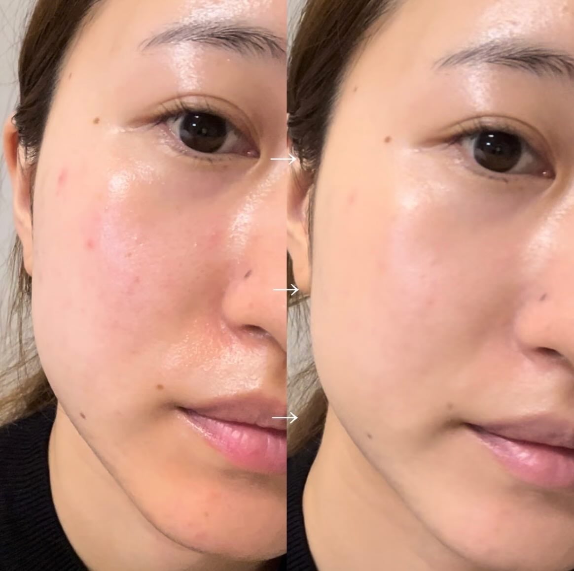 F5 リフレッシュクッション/keybo/クッションファンデーションを使ったクチコミ(3枚目)