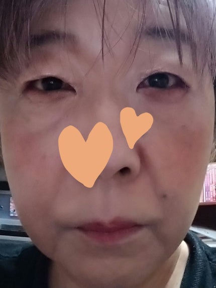 フリーダムリキッドファンデーション/xixi/リキッドファンデーションを使ったクチコミ(3枚目)