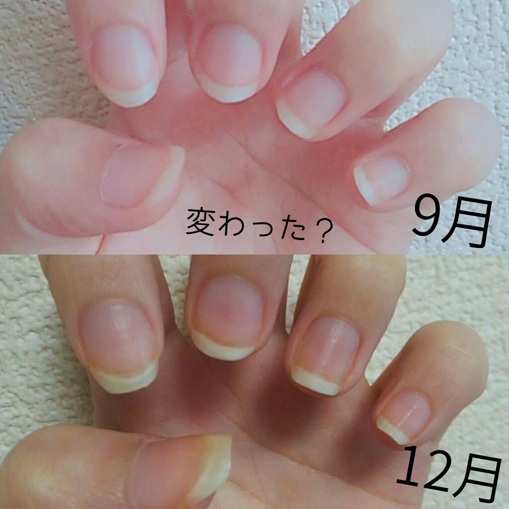 ネイルオイル セリアの口コミ 超優秀 100均で買えるおすすめネイルオイル トリートメント 深爪治そう と思 By ぽのの 混合肌 Lips