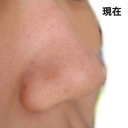 ドット・ウォッシー洗顔石鹸/ペリカン石鹸/洗顔石鹸を使ったクチコミ(4枚目)