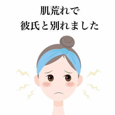 私が伝えたいことは
ニキビができた時は信用できる皮膚科に行く
ということです。
評判の良い病院はきちんと自分に合った薬を処方してくれます。
自己流や友達のやり方を真似するのではなく
専門の人に相談するの