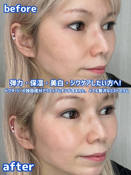 ドクタージー ブラックスネイル コラーゲンミスト/Dr.G/ミスト状化粧水を使ったクチコミ(4枚目)