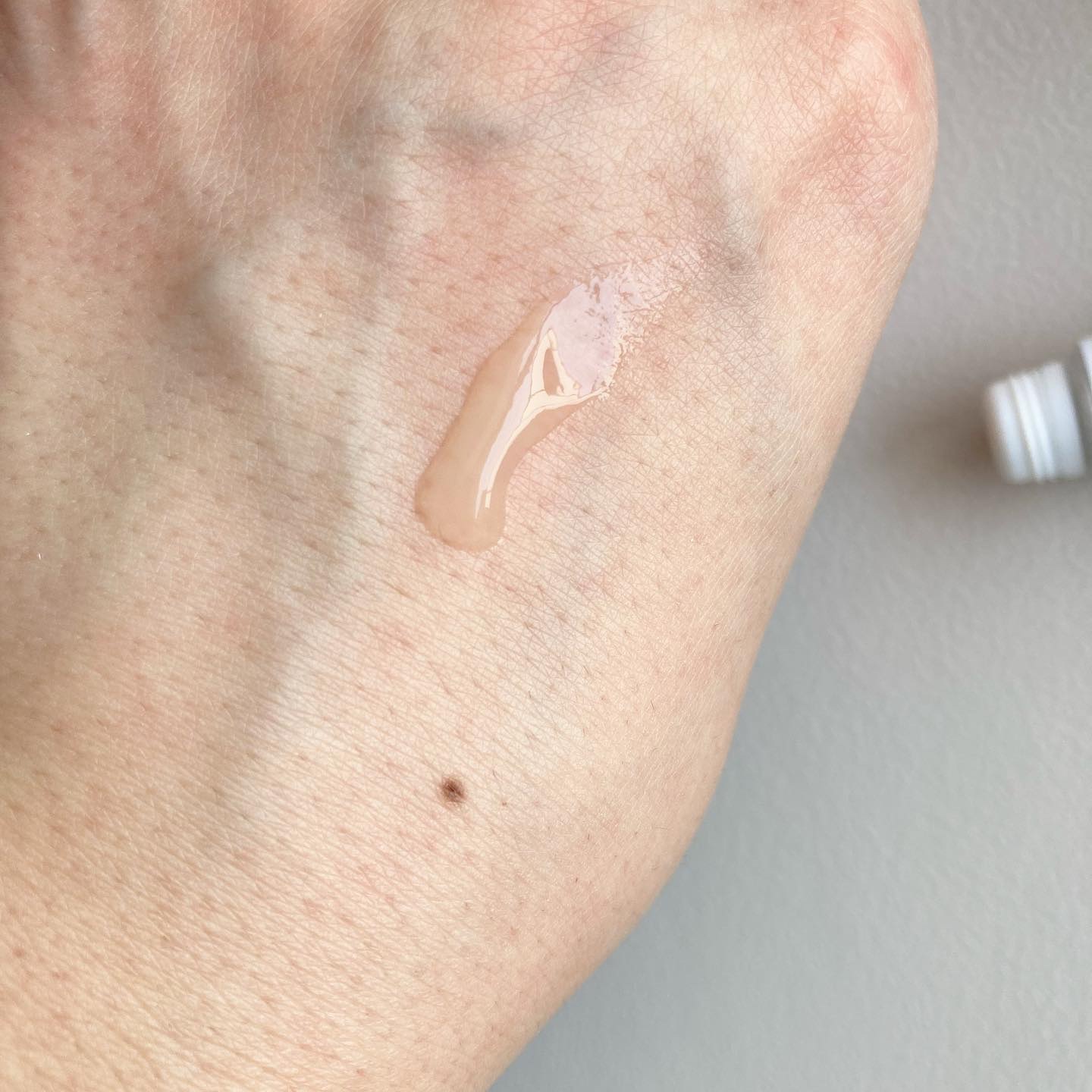 ニキビあとケアジェル/アットノン/その他スキンケアを使ったクチコミ（3枚目）