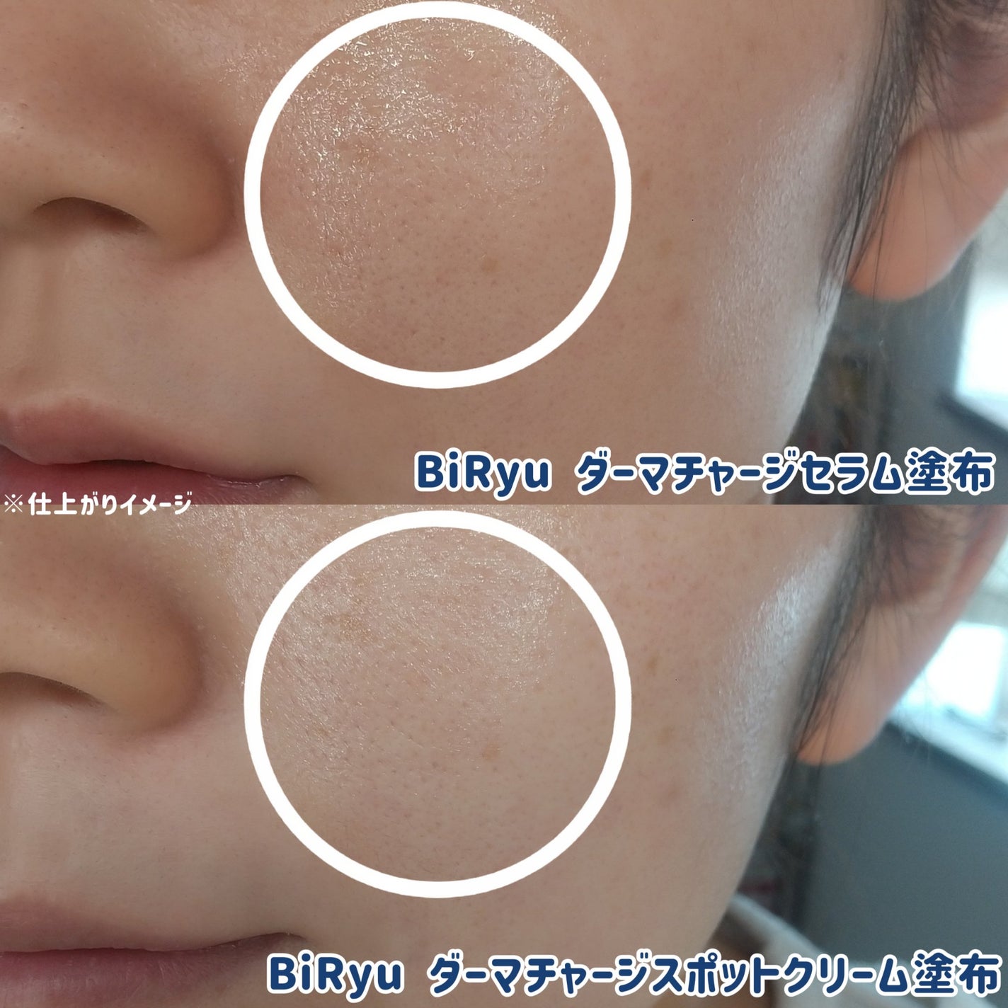 BiRyu ダーマチャージセラム/BiRyu/美容液を使ったクチコミ(5枚目)