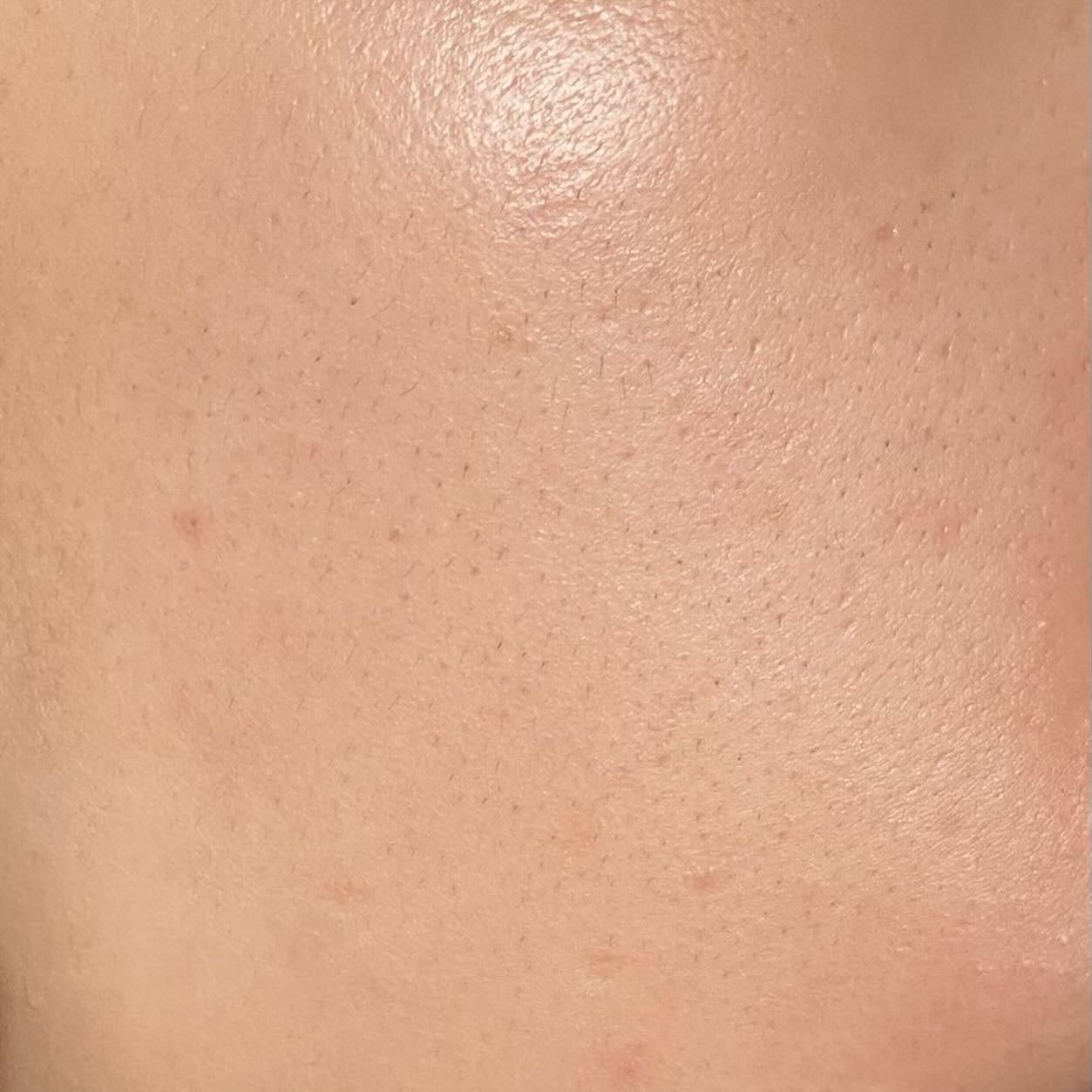 ポアタイトニングブーストセラム/CELORABY/美容液を使ったクチコミ(4枚目)