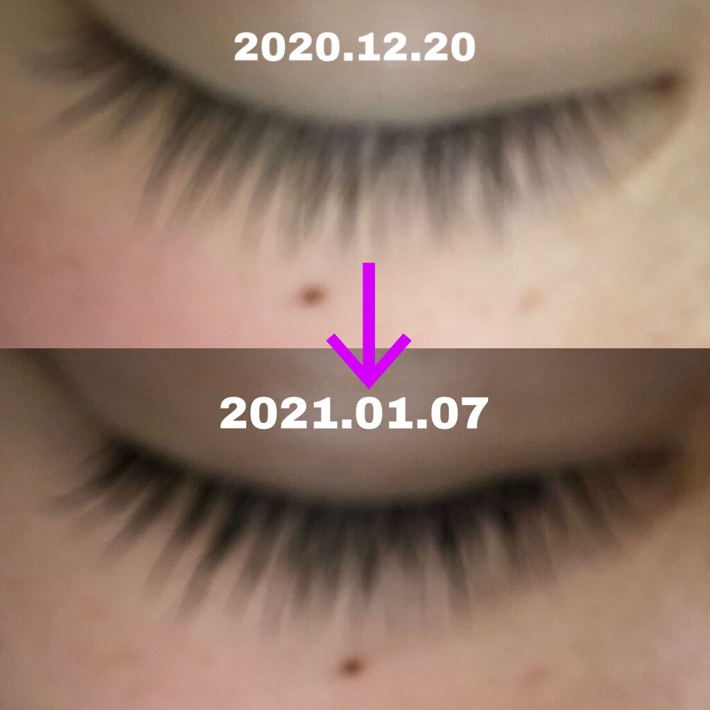 ラッシュ セラム/ロレアル パリ/まつげ美容液を使ったクチコミ（1枚目）