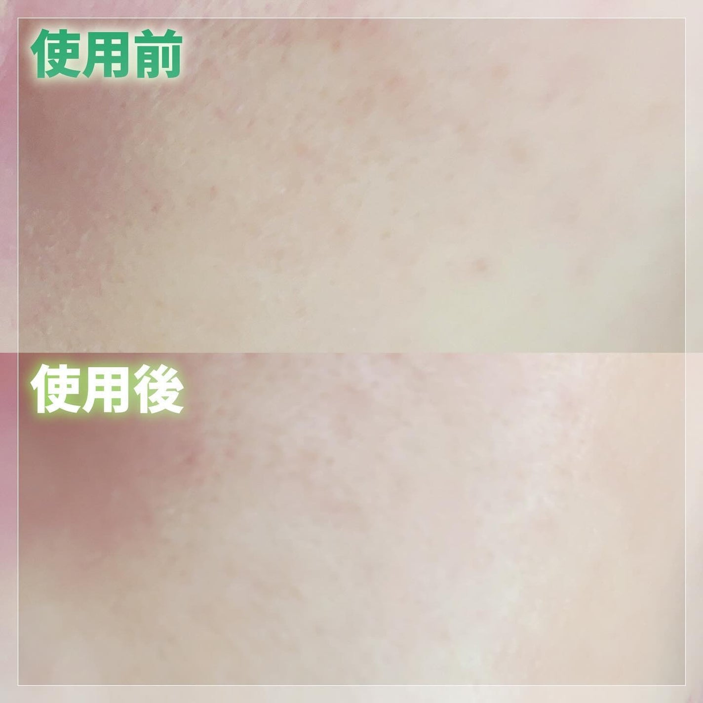 CICA デイリースージングマスク/VT/シートマスク・パックを使ったクチコミ(8枚目)