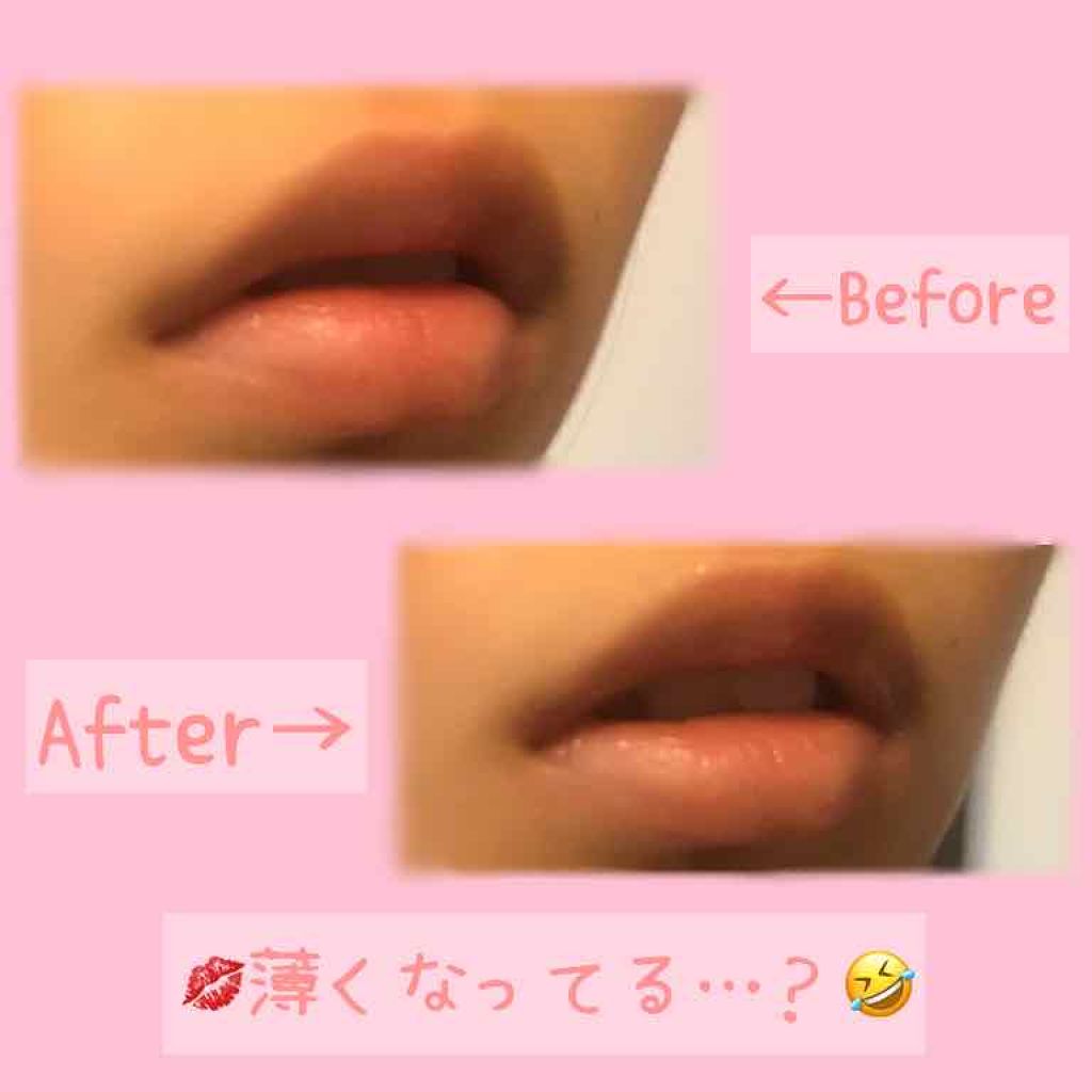 38°C / 99°F リップトリートメント (リップ美容液)/UZU BY FLOWFUSHI/リップケアを使ったクチコミ（3枚目）