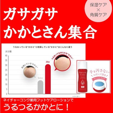 ネイチャーコンク薬用フットケアローション/ネイチャーコンク/レッグ・フットケアを使ったクチコミ（1枚目）