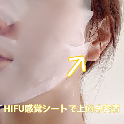 ルルルン ハイドラ V マスク/ルルルン/シートマスク・パックを使ったクチコミ(4枚目)