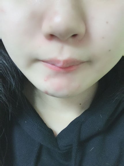 ハトムギ化粧水(ナチュリエ スキンコンディショナー R )/ナチュリエ/化粧水を使ったクチコミ(2枚目)