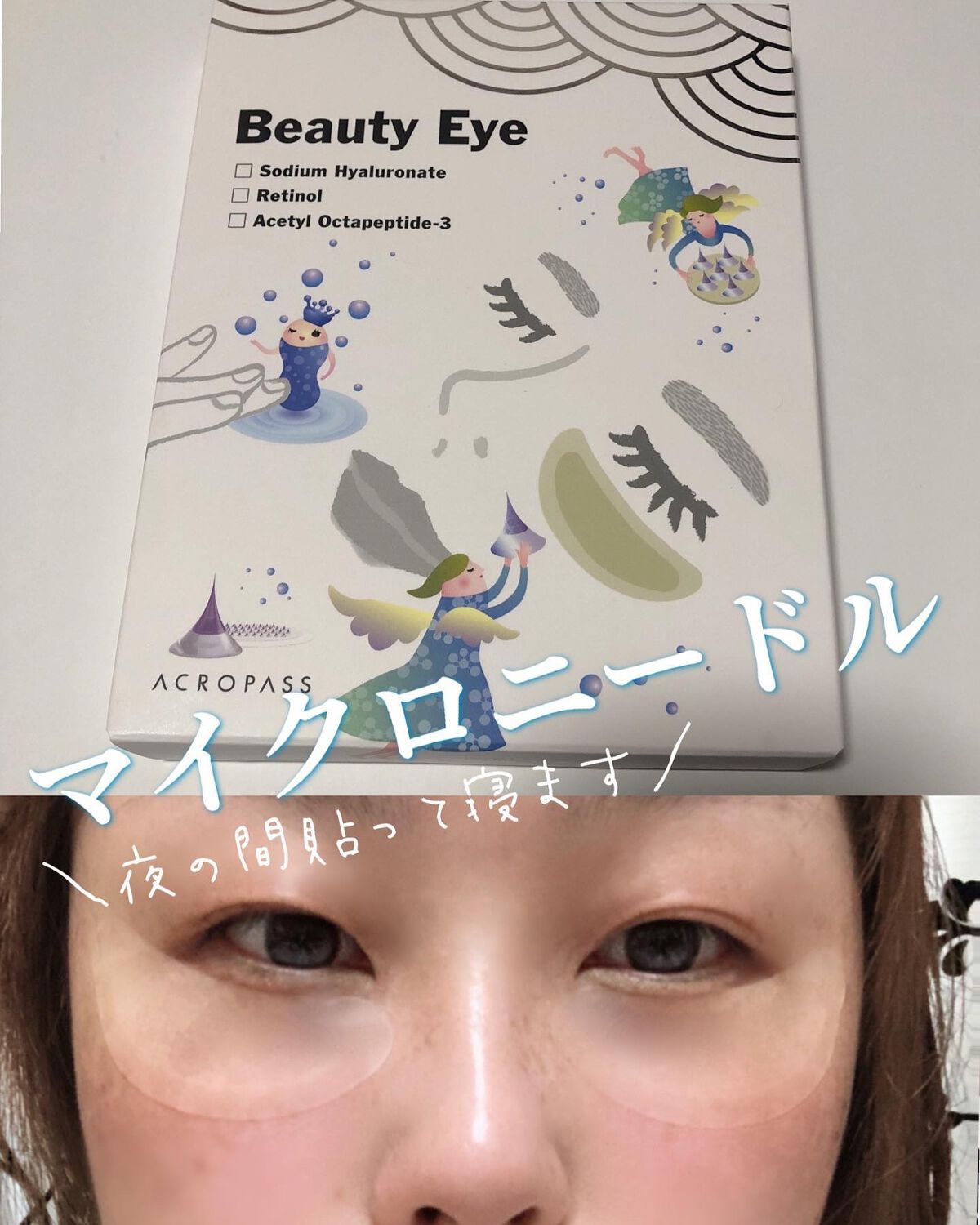 lala on LIPS 「寝ながら美容★目元専用マイクロニードル!レチノールで素肌ケア貼..」(1枚目)