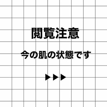 ララ on LIPS 「自分なりに努力してみます！・自分に自信が持てるようになりたい‼..」（2枚目）