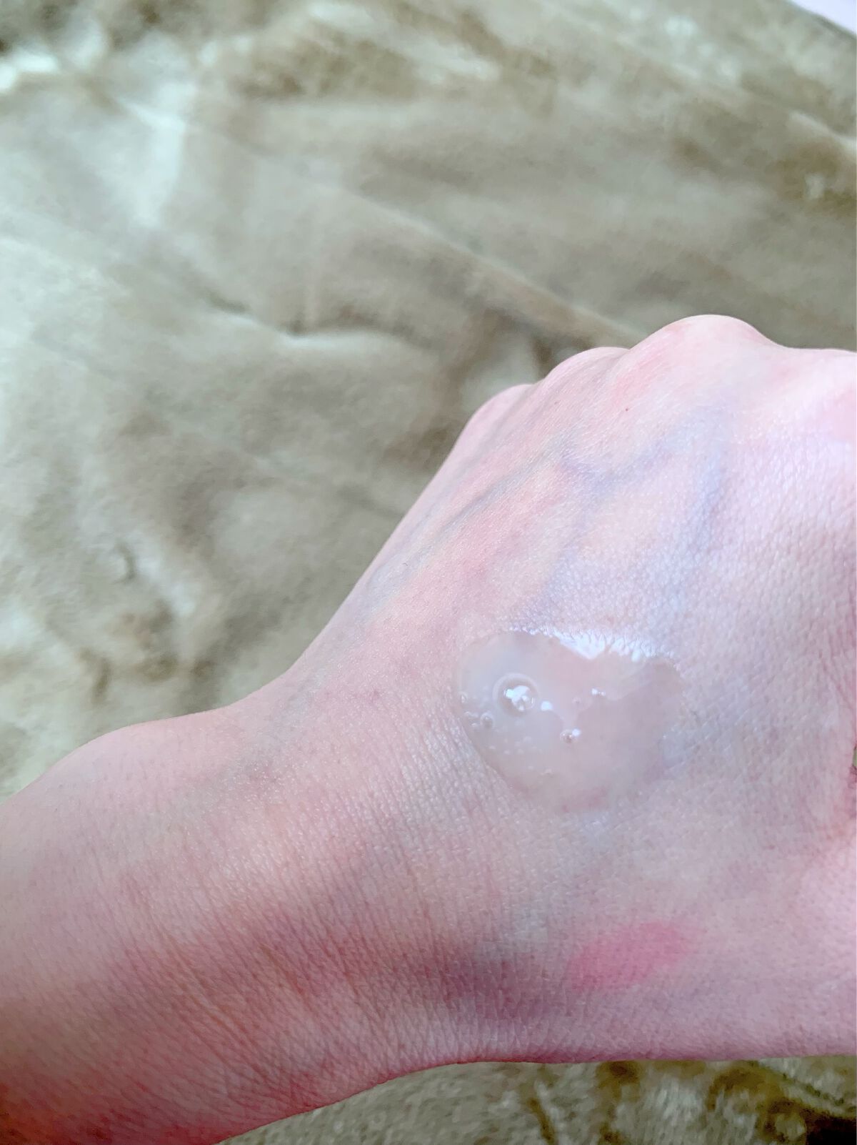 グリーンダーマCICAセラム/ネイチャーリパブリック/美容液を使ったクチコミ(2枚目)