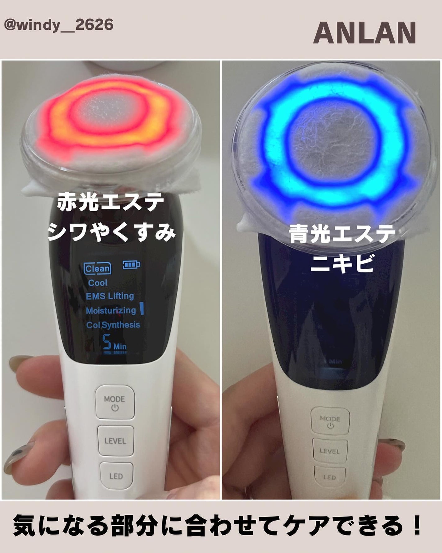 多機能温冷美顔器/ANLAN/美顔器・マッサージを使ったクチコミ(5枚目)