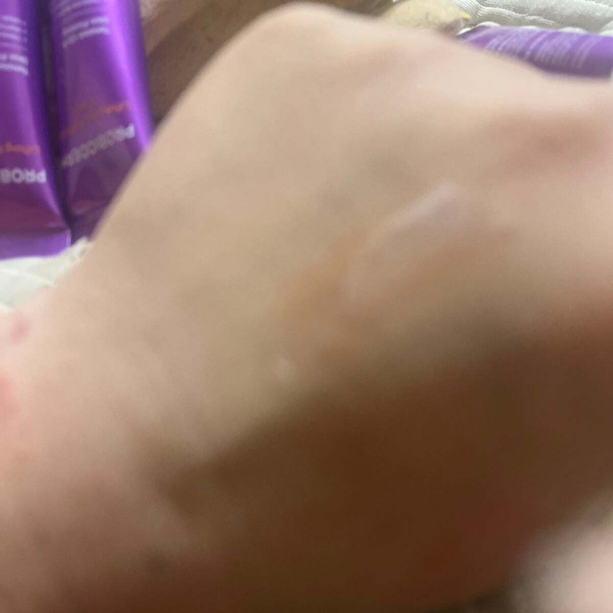 プロバイオダーム リフティング アイリンクルクリーム/BIOHEAL BOH/アイケア・アイクリームを使ったクチコミ(2枚目)