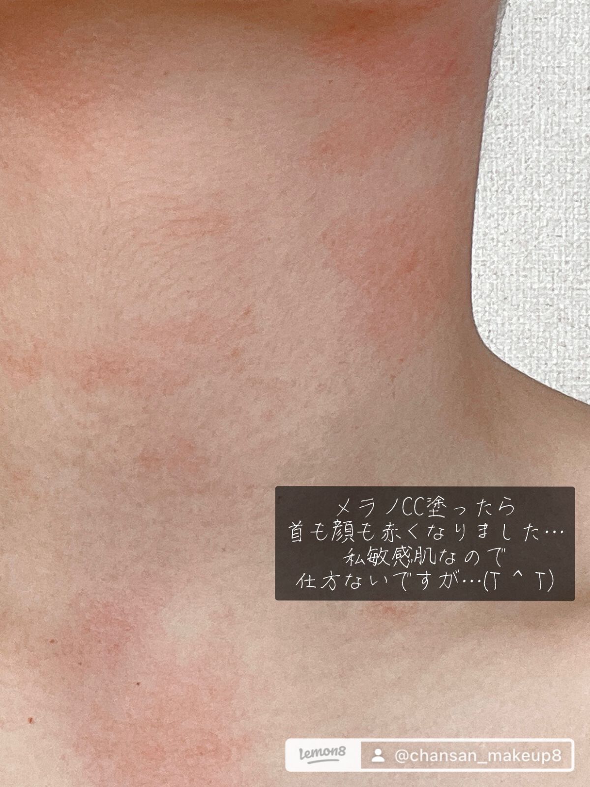 薬用しみ集中対策 プレミアム美容液/メラノCC/美容液を使ったクチコミ（2枚目）