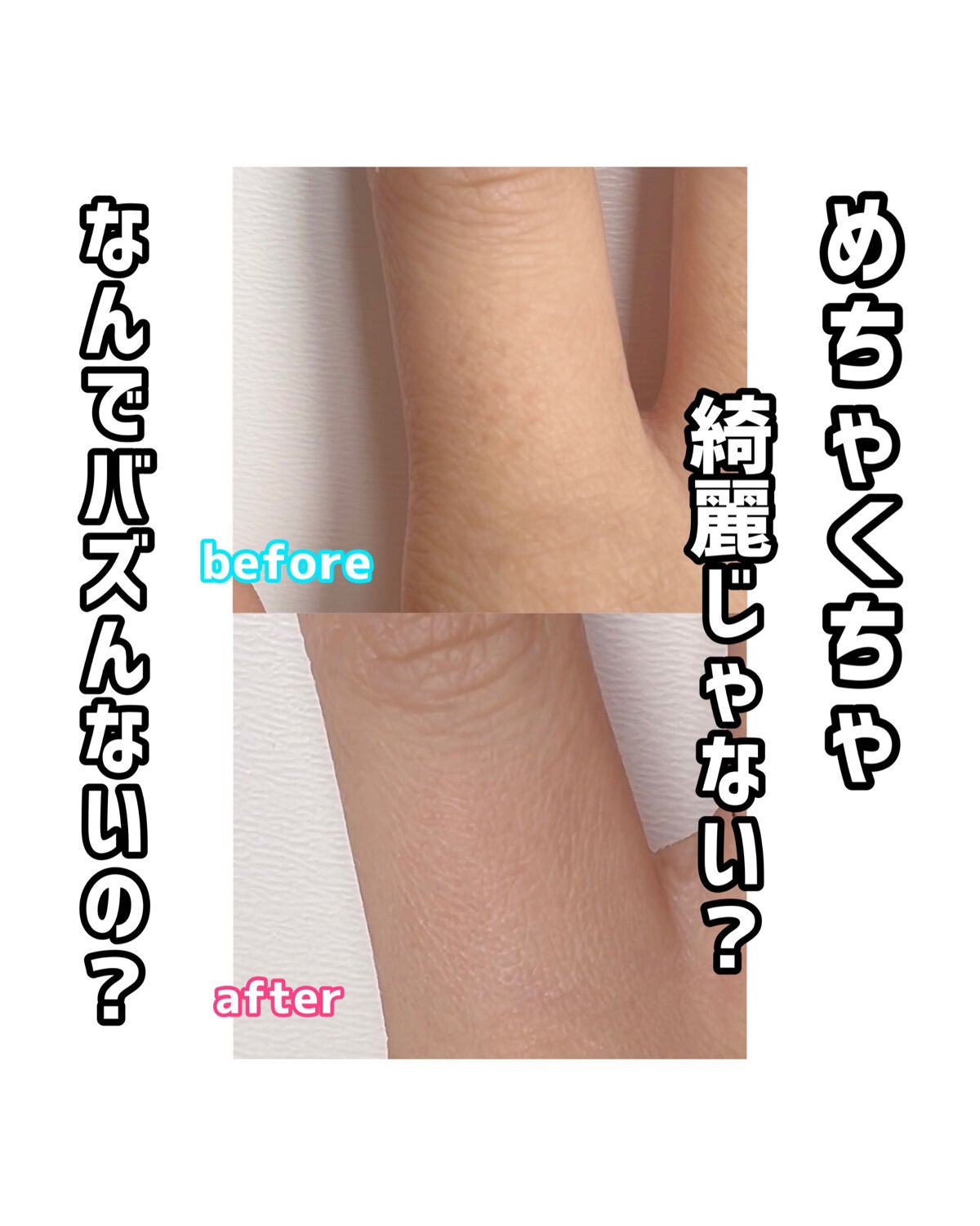 Rã¡ããð§žãã©ããâã³ã¹ã¡ã»çŸå®¹ãªã¿ã¯ on LIPS ãé©åœãããïŒïŒâ€ïžâð¥ãã€ã«ã®åçãæ®ãæãæå
ã«éäžããäœã..ãïŒ2æç®ïŒ