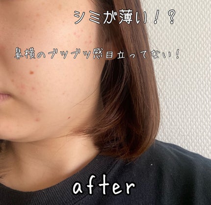 よう on LIPS 「『my'sパーソナライズセラム』2箱目使い切ってました!顔のお..」(4枚目)