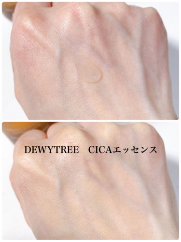 DEWYTREE CICA 100 エッセンスのクチコミ「敏感肌寄りの乾燥肌。
その上揺らぎ肌の私、マスクと花粉で肌状態最悪。
だから、今人気の肌鎮静ア.....」（3枚目）