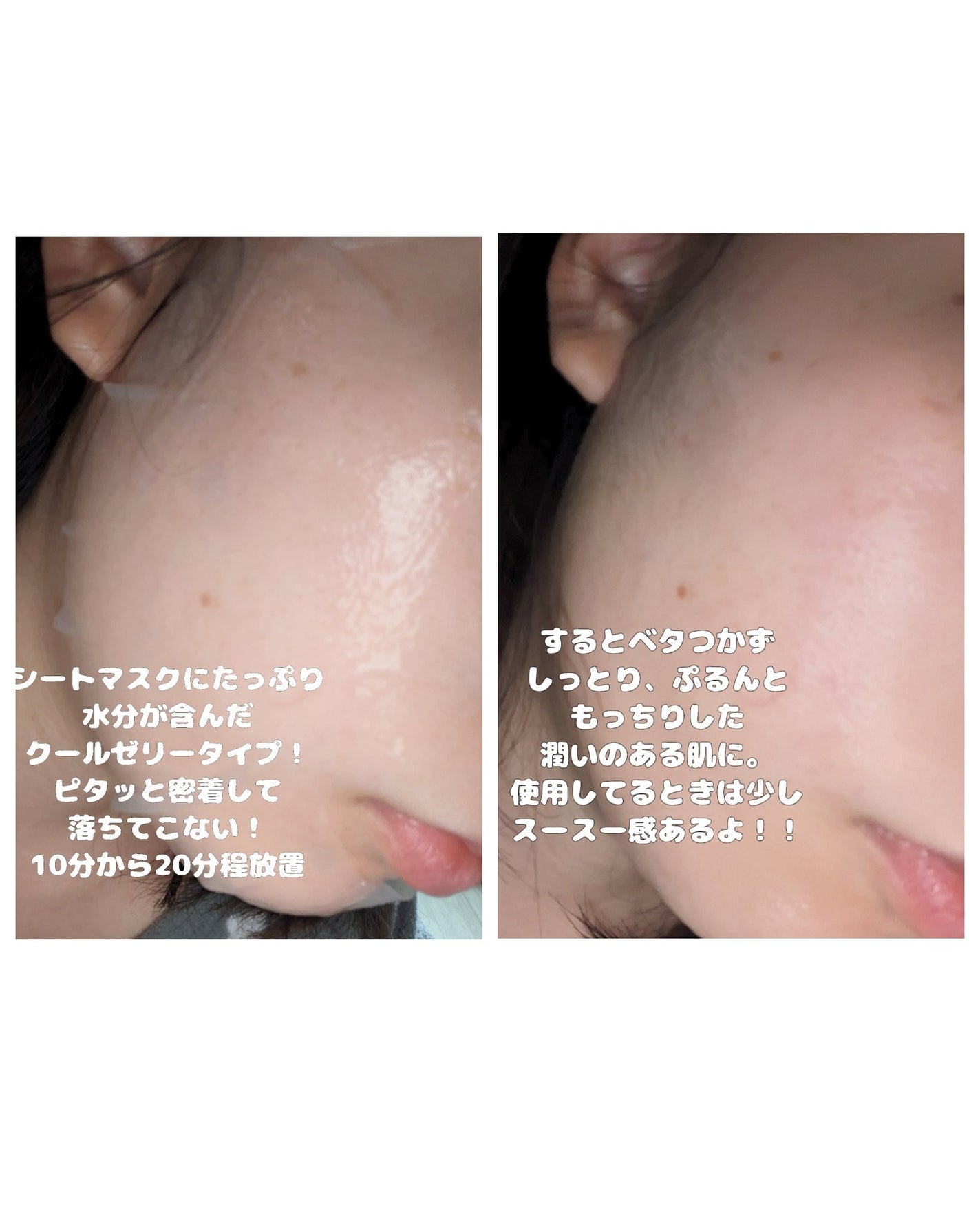 レッドブレミッシュ クールスージングマスク/Dr.G/シートマスク・パックを使ったクチコミ(4枚目)