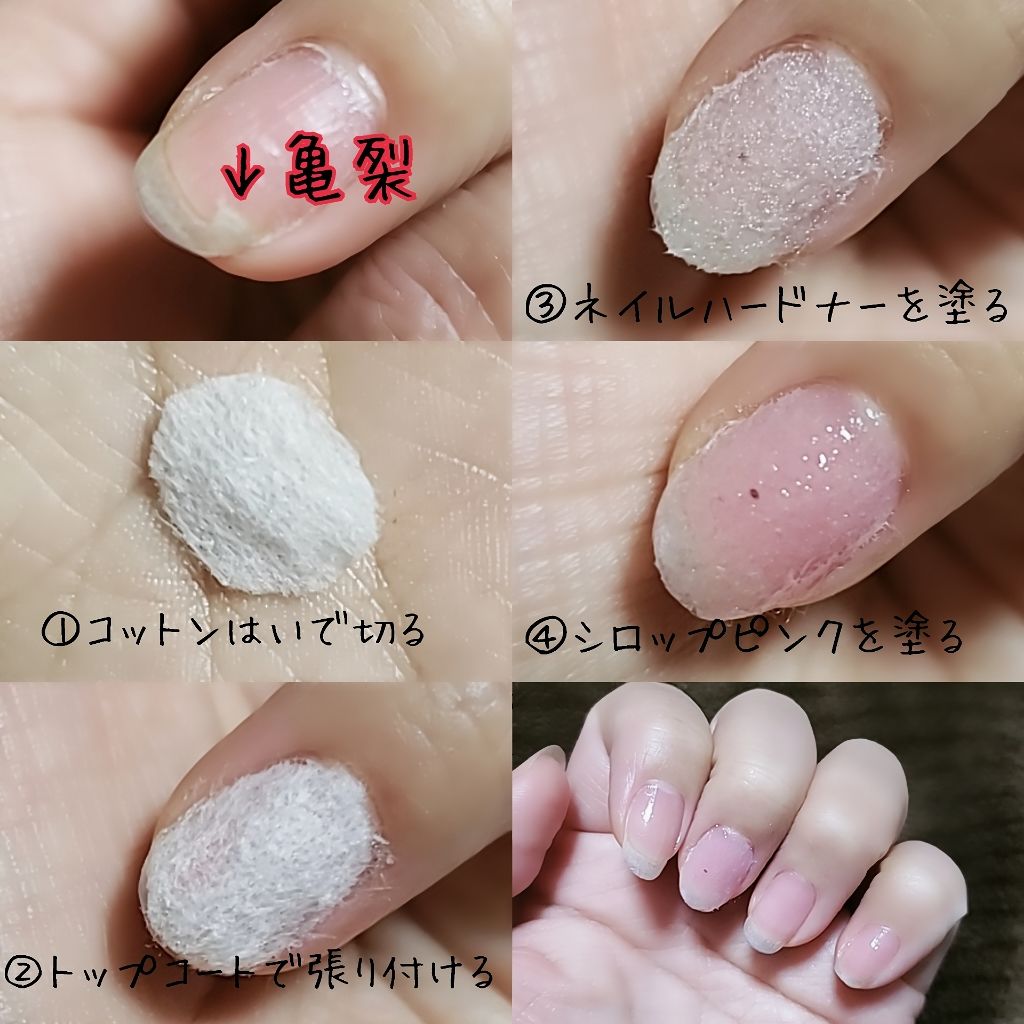 生成カットコットン 無印良品を使った口コミ 亀裂ができた爪の応急措置 画像 使用した物 By ワド氏 アトピー肌 Lips