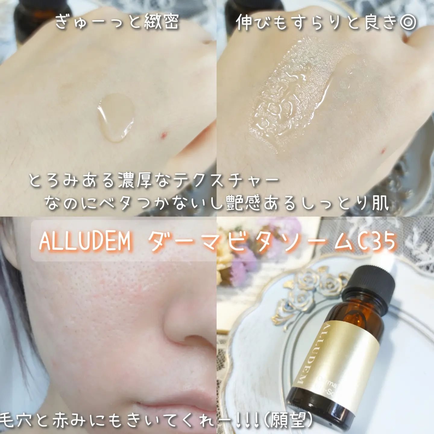 ダーマビタソームC35/ALLUDEM/美容液を使ったクチコミ（2枚目）