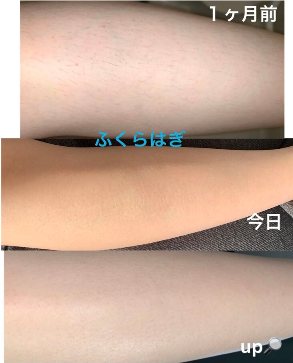 光脱毛器 VIO/Sarlisi/家庭用脱毛器を使ったクチコミ(4枚目)