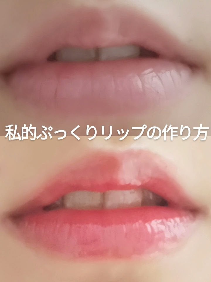 リップベビーフルーツ/メンソレータム/リップクリームを使ったクチコミ(1枚目)