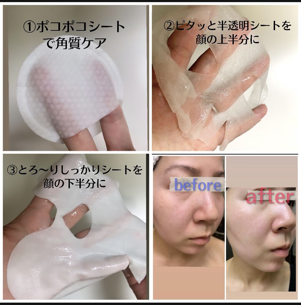 デュイセル プライベートケアマスク/DEWYCEL/シートマスク・パックを使ったクチコミ（2枚目）