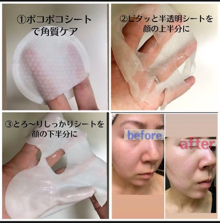 デュイセル プライベートケアマスク/DEWYCEL/シートマスク・パックを使ったクチコミ(2枚目)