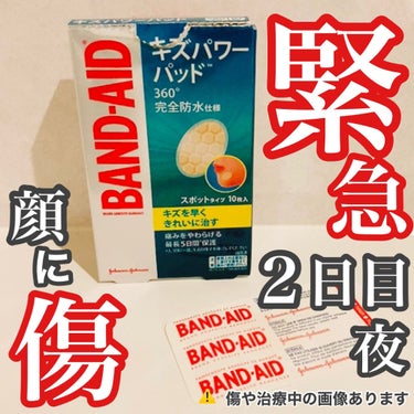 顔に傷が出来て、
キズパワーパッドつけてから1日経ちました。

＊＊＊＊＊＊♪＊＊＊＊♪＊＊
■バンドエイド キズパワーパッド
　スポットタイプ

お風呂も問題なく入れました！
クレンジングの時は少し気