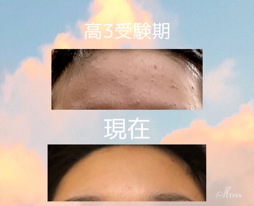 DHC ビタミンBミックス/DHC/美容サプリメントを使ったクチコミ(9枚目)