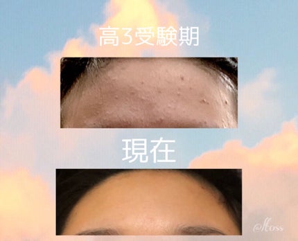 DHC ビタミンBミックス/DHC/美容サプリメントを使ったクチコミ(9枚目)